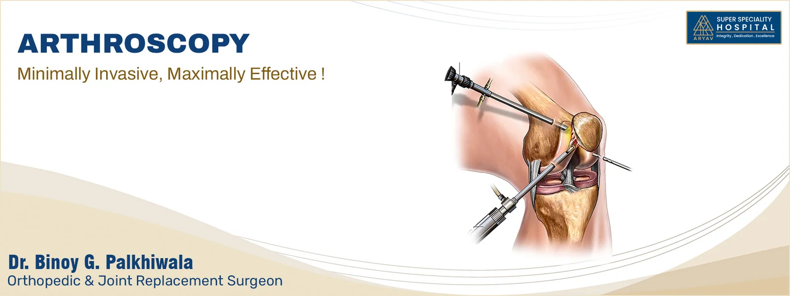 Arthroscopy