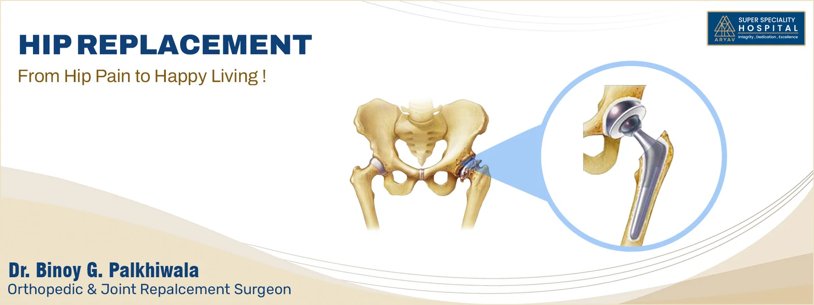 Hip Replacement