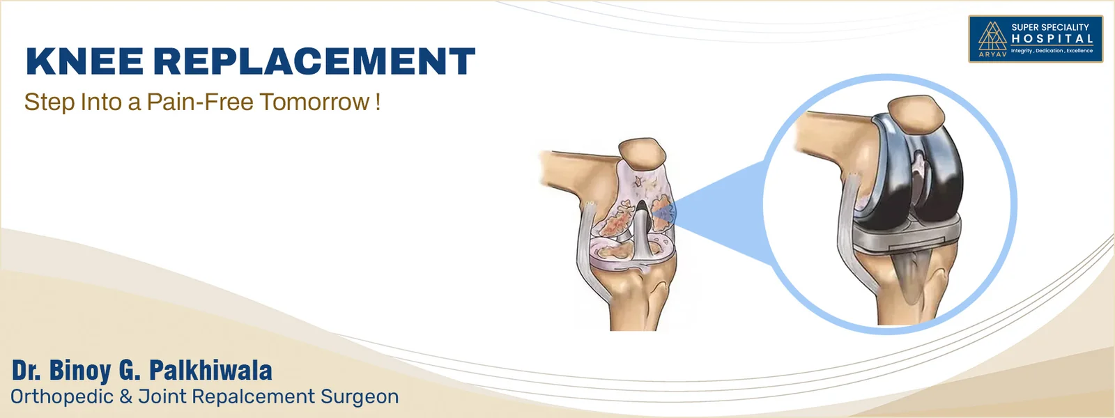 Knee Replacement