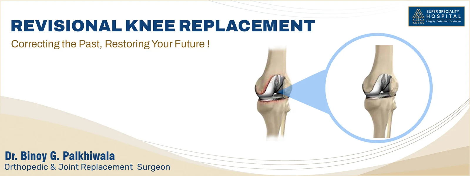 Revision Knee Replacement