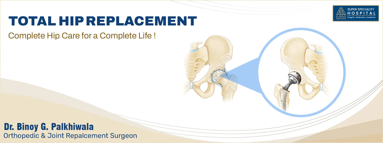 Total Hip Replacement
