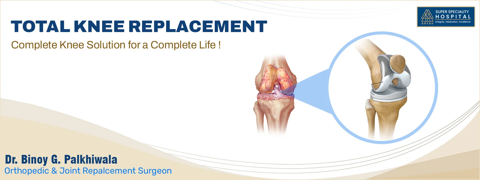 Total Knee Replacement